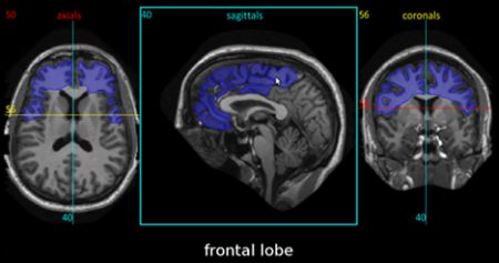 Cervello e Neuroanatomia: Completo Atlante Cerebrale 3D