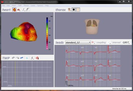 Elettrocardiogramma - Simulatore per studio e ricerca ECG