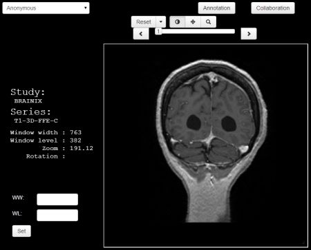 Immagini BioMediche: Guardale online con Jack Imaging Viewer