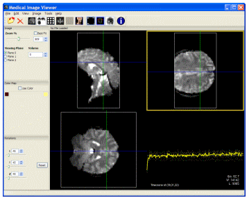 Medical Image Viewer per vedere le Immagini BioMediche